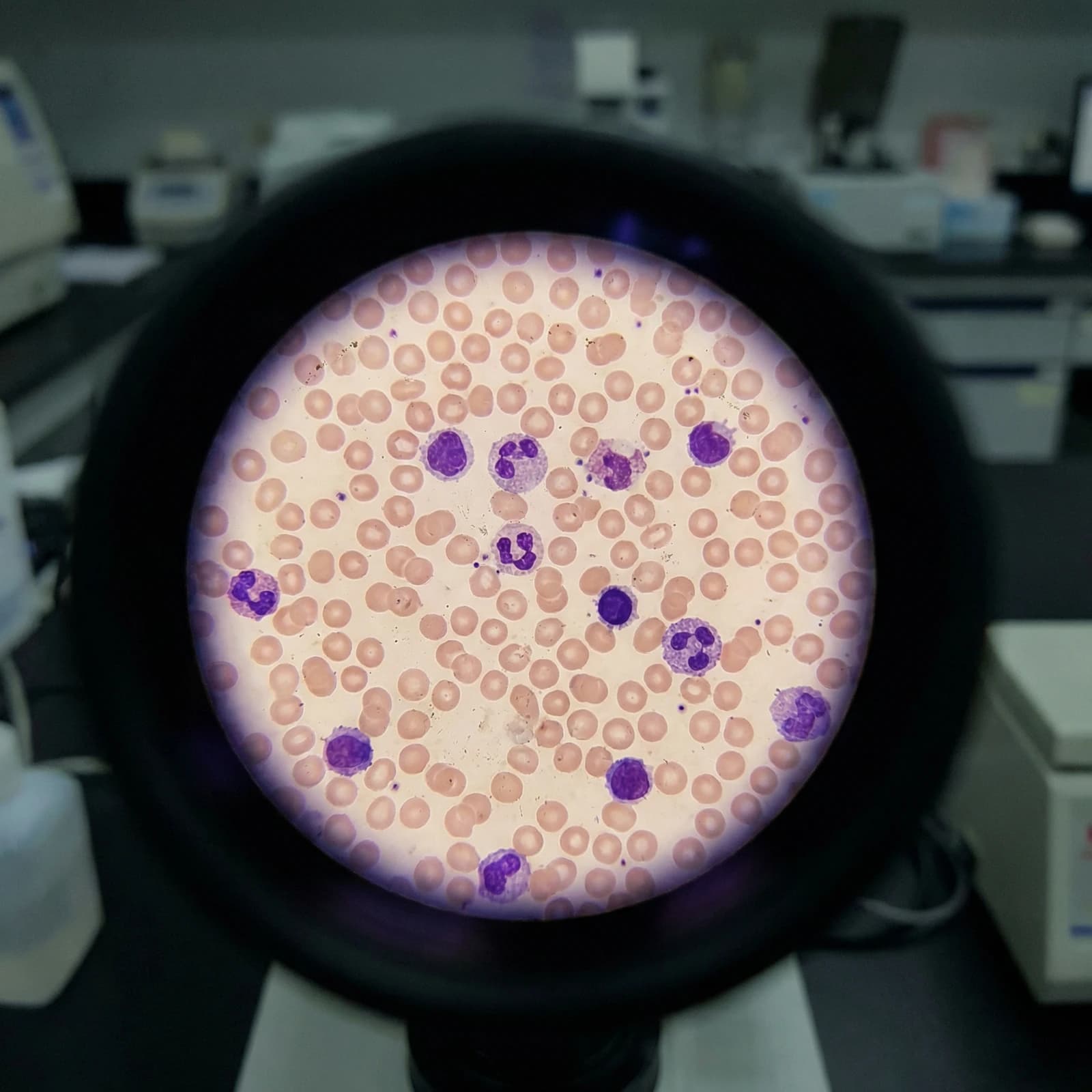ECLIA & Fluorescence Technology - 2