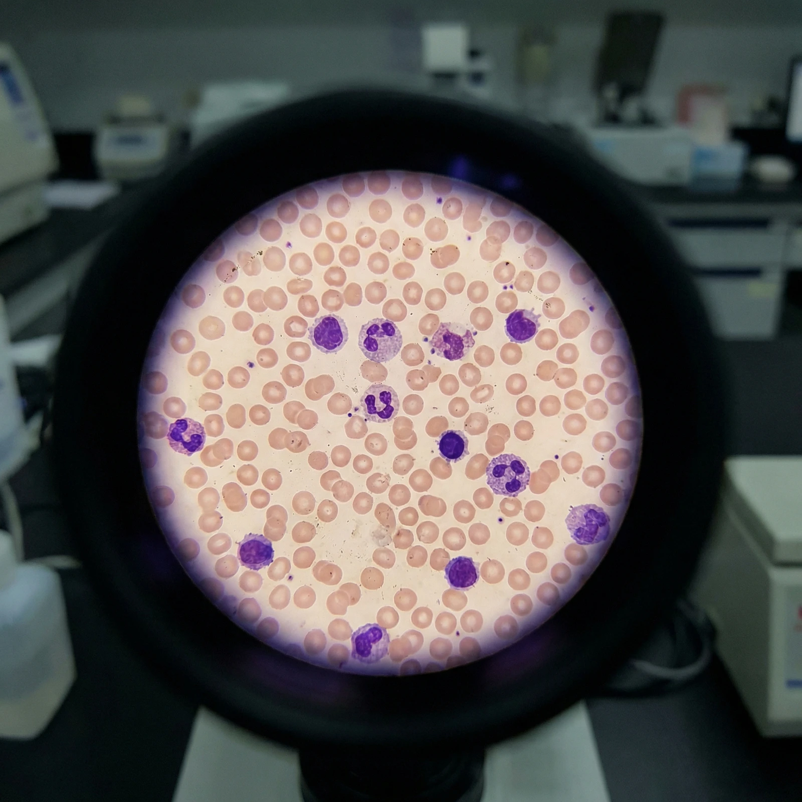 Τεχνολογία ECLIA & Fluorescence - 2