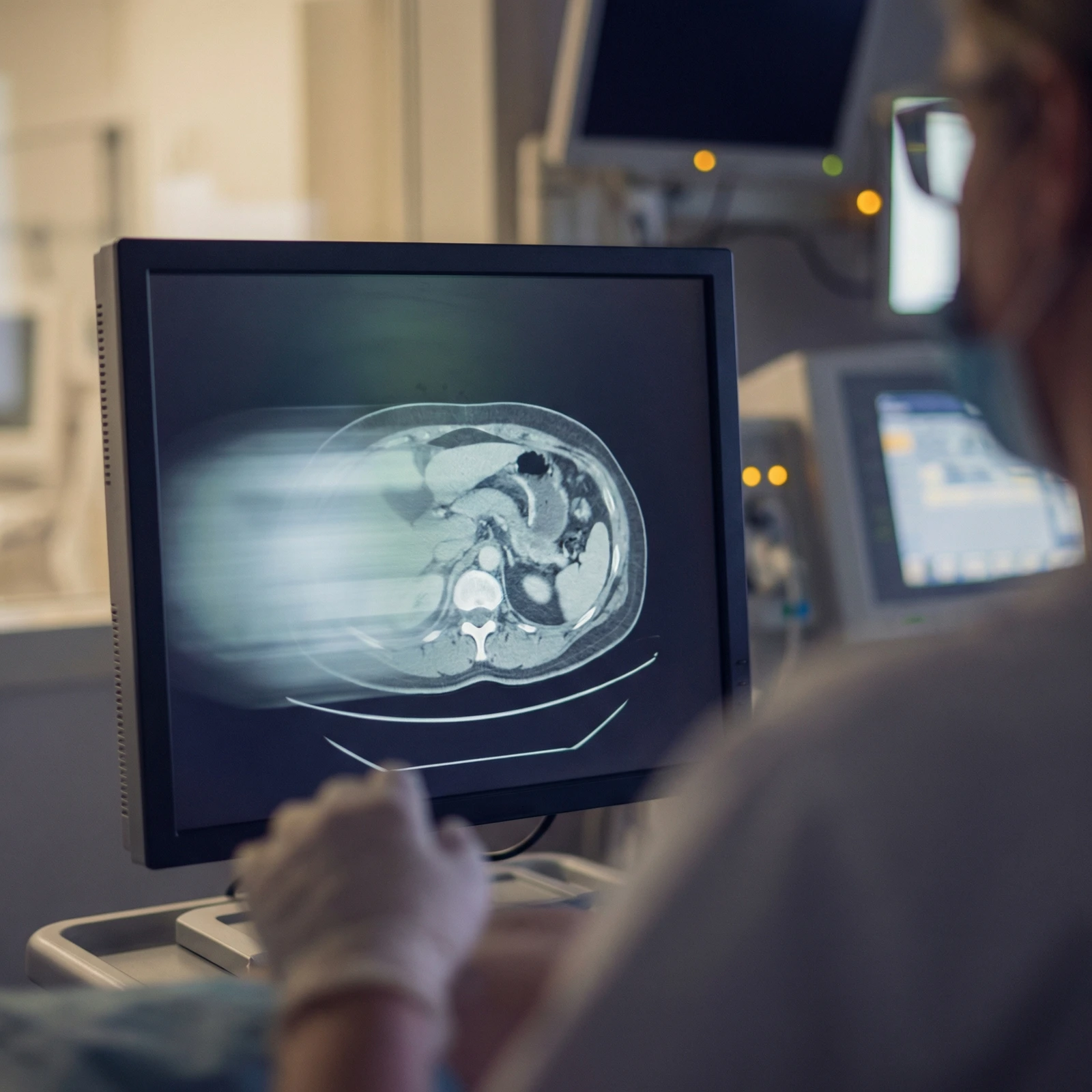 Body Composition Analysis - 3