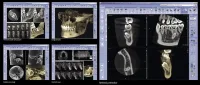 dental-scans